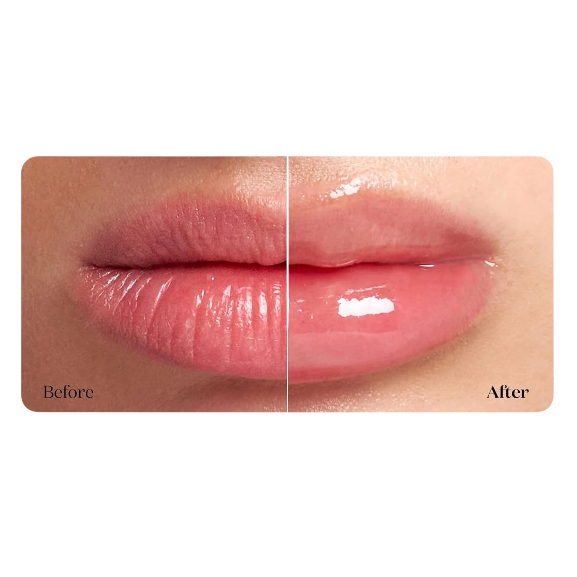 VT Cosmetics Reedle Shot Lip Plumper Beginner lūpų putlintojas 3